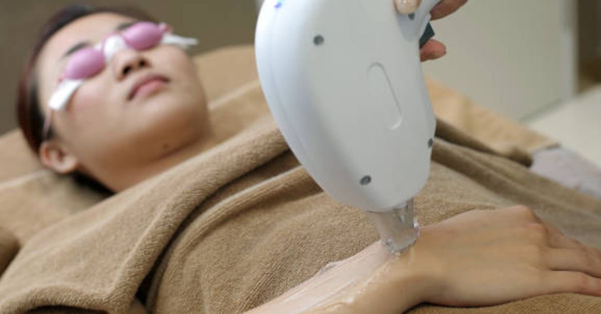 Brazilian Laser Hair Removal